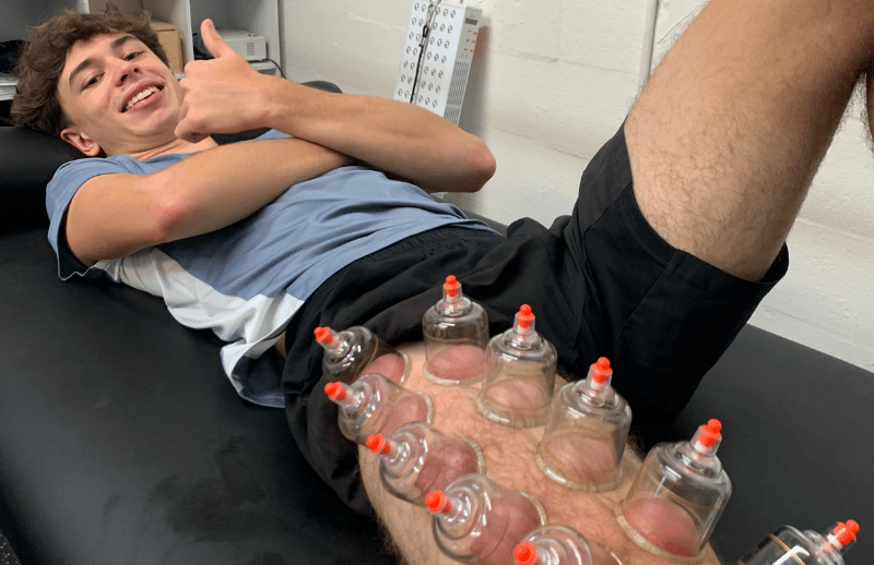 Boca Raton Cupping Therapy | Faster Recovery for Athletes