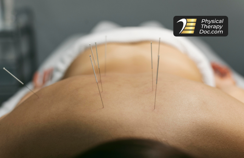 Trusted Dry Needling Therapy for Athletes and Active Adults in Boca Raton