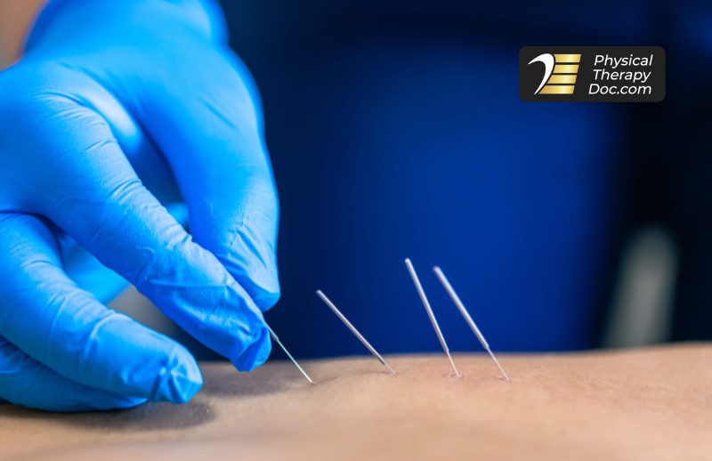 Dry Needling for Lower Back Pain in Boca Raton